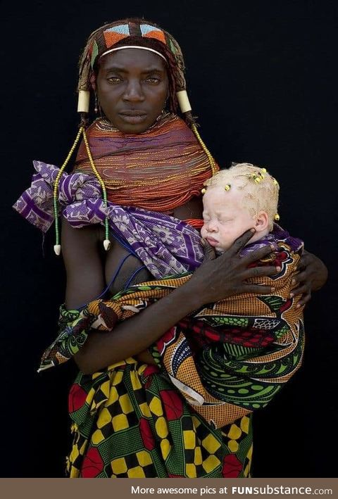 Albino baby girl and her Mwila mother