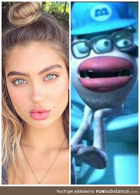 How women with lip injections think they look v.S. How they really look