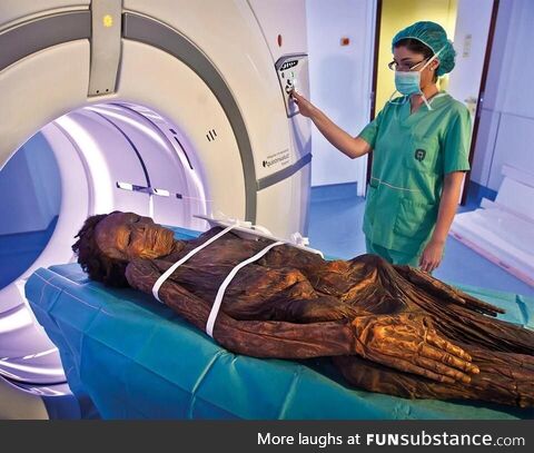 Patient burned alive after failed MRI