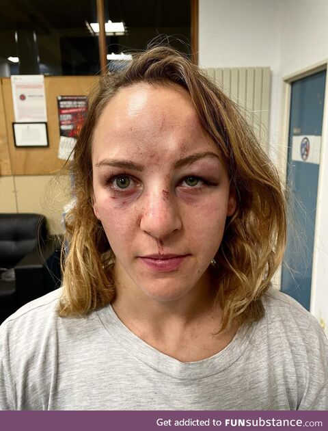 Margaux Pinot posted her picture after being attacked by her partner - he was released