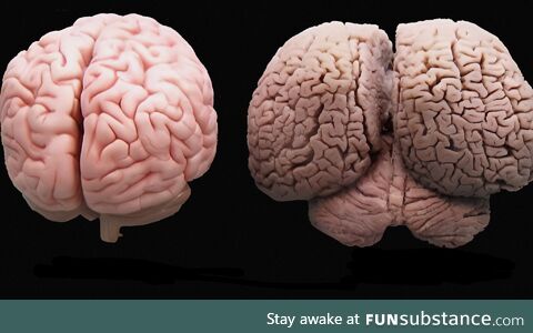 A human brain on the left, a dolphin brain on the right