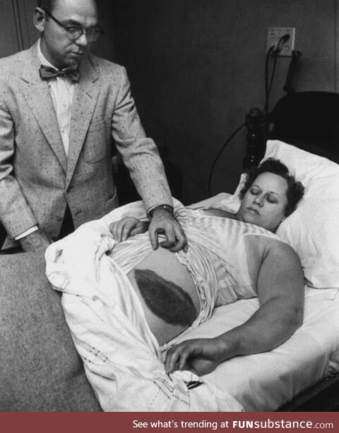 Ann Hodges, the only human being in recorded history to be hit by a meteorite. And