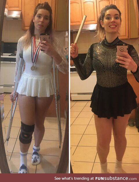 Was on Crutches Last Halloween & Went as Nancy Kerrigan - This Year Obviously Had to be