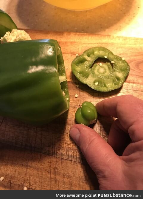 Delivered by C section- welcome to the world lil pepp